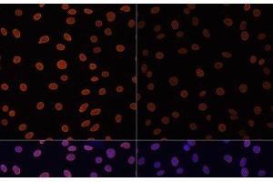Immunofluorescence analysis of C6 cells using Acetyl-Histone H4-K12 Polyclonal Antibody at dilution of 1:100. (Histone H4 抗体  (acLys12))