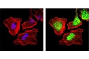 Immunofluorescence (IF) image for anti-Keratin 5 (KRT5) antibody (ABIN1106933) (Cytokeratin 5 抗体)