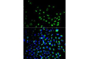 Immunofluorescence analysis of HeLa cell using UCHL1 antibody. (UCHL1 抗体)