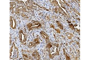 IHC analysis of PDIA5 using anti-PDIA5 antibody (ABIN7601801).