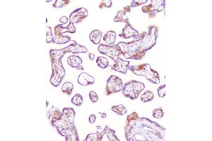 IHC analysis of RP2 using anti-RP2 antibody (ABIN6719513).