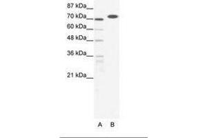 Image no. 1 for anti-RB-Associated KRAB Zinc Finger (RBAK) (AA 447-496) antibody (ABIN202880) (RBAK 抗体  (AA 447-496))