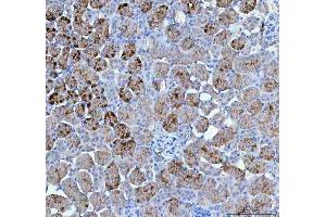 IHC analysis of PAH using anti-PAH antibody (ABIN5518942).