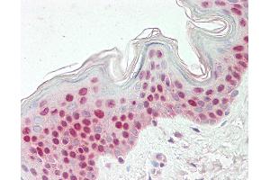 Human Skin: Formalin-Fixed, Paraffin-Embedded (FFPE).