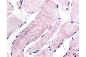 Immunohistochemical (Formalin/PFA-fixed paraffin-embedded sections) staining in human skeletal muscle with WNK1 polyclonal antibody . (WNK1 抗体)