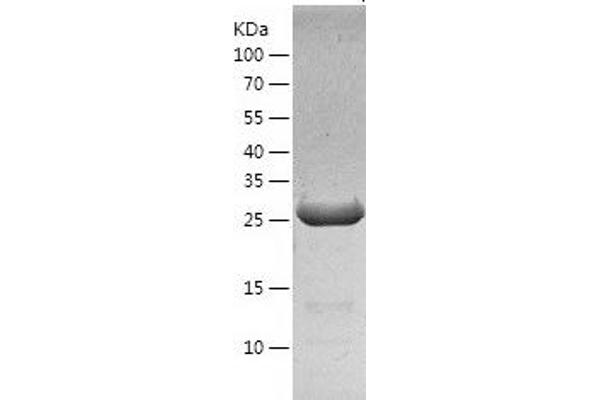 RGMA Protein (AA 169-422) (His tag)