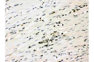 Anti- RUNX3 Picoband antibody, IHC(P): Human Intestinal Cancer Tissue (RUNX3 抗体  (AA 128-270))