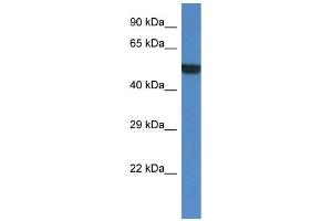 WB Suggested Anti-Porcn Antibody Titration: 1. (PORCN 抗体  (Middle Region))