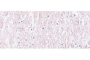 Immunohistochemistry of paraffin-embedded Human brain tissue using SMPD2 Polyclonal Antibody at dilution of 1:90(x200) (SMPD2 抗体)