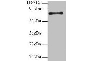 Western blot All lanes: RPS18 antibody at 2 μg/mL + 293T whole cell lysate Secondary Goat polyclonal to rabbit IgG at 1/15000 dilution Predicted band size: 18 kDa Observed band size: 75 kDa (RPS18 抗体  (AA 2-152))