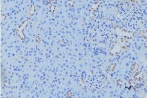 ABIN6279577 at 1/100 staining Mouse kidney tissue by IHC-P.