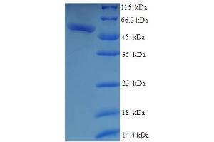 SDS-PAGE (SDS) image for Galactose Mutarotase (Aldose 1-Epimerase) (GALM) (AA 2-342) protein (His-SUMO Tag) (ABIN5711670) (GALM Protein (AA 2-342) (His-SUMO Tag))