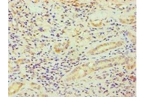 Immunohistochemistry of paraffin-embedded human kidney tissue using ABIN7164363 at dilution of 1:100 (DDX5 抗体  (AA 1-290))