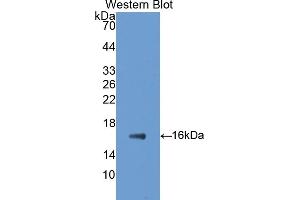 Detection of Recombinant GAD1, Rat using Polyclonal Antibody to Glutamate Decarboxylase 1, Brain (GAD1) (GAD 抗体  (AA 1-97))