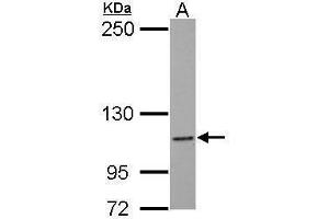 WB Image Sample (30 ug of whole cell lysate) A: MCF-7 5% SDS PAGE antibody diluted at 1:1000 (NLRC4 抗体  (N-Term))