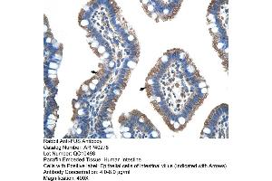 Rabbit Anti-FUS Antibody  Paraffin Embedded Tissue: Human Intestine Cellular Data: Epithelial cells of intestinal villas Antibody Concentration: 4. (FUS 抗体  (N-Term))