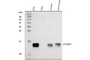 Western blot analysis of FABP4 using anti-FABP4 antibody (ABIN3043827).