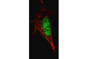 Fluorescent confocal image of SY5Y cells stained with SOX2 antibody. (SOX2 抗体)