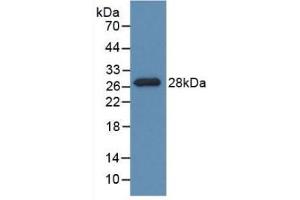 Detection of Recombinant PDXK, Rat using Polyclonal Antibody to Pyridoxal Kinase (PDXK) (PDXK 抗体  (AA 35-251))