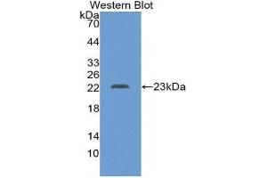 Western Blotting (WB) image for anti-Chorionic Somatomammotropin Hormone 1 (Placental Lactogen) (CSH1) (AA 28-192) antibody (ABIN1869838) (CSH1 抗体  (AA 28-192))