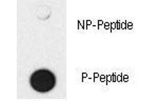Dot blot analysis of phospho-SMAD4 antibody. (SMAD4 抗体  (pThr277))