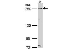 WB Image Sample (30 ug of whole cell lysate) A: Hela 5% SDS PAGE GBF1 antibody antibody diluted at 1:1000 (GBF1 抗体  (N-Term))