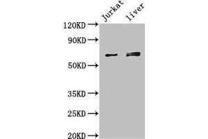 Western Blot Positive WB detected in: Jurkat whole cell lysate, Mouse liver tissue All lanes: KLHL2 antibody at 3 μg/mL Secondary Goat polyclonal to rabbit IgG at 1/50000 dilution Predicted band size: 66, 67, 57 kDa Observed band size: 66, 67 kDa (KLHL2 抗体  (AA 1-155))