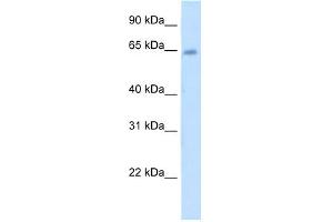 WB Suggested Anti-STS Antibody Titration:  5. (STS 抗体  (C-Term))