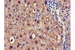 Immunohistochemistry of paraffin-embedded human liver tissue using ABIN7142154 at dilution of 1:100 (HRSP12 抗体  (AA 2-137))