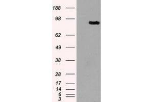 HEK293T cells were transfected with the pCMV6-ENTRY control (Left lane) or pCMV6-ENTRY PROM2 (Right lane) cDNA for 48 hrs and lysed. (Prominin 2 抗体)