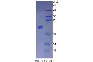 SDS-PAGE analysis of Human CALML3 Protein. (CALML3 蛋白)