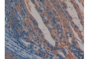 Detection of ALCAM in Mouse Stomach Tissue using Polyclonal Antibody to Activated Leukocyte Cell Adhesion Molecule (ALCAM) (CD166 抗体  (AA 28-527))