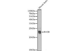 Western blot analysis of extracts of Mouse brain using RHOB Polyclonal Antibody at dilution of 1:1000. (RHOB 抗体)