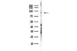 Western blot analysis of lysates from Mouse brain, using TPCN1 Antibody at 1/1000 dilution.