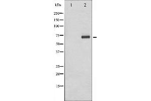 Western blot analysis of Tyrosinase expression in COS7 cells. (TYR 抗体)