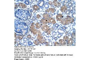 Rabbit Anti-ASS Antibody  Paraffin Embedded Tissue: Human Kidney Cellular Data: Epithelial cells of renal tubule Antibody Concentration: 4. (ASS1 抗体  (C-Term))
