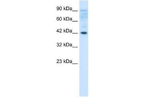 Human Jurkat; Jurkat Whole Cell; ZFP1 antibody - N-terminal region in Human Jurkat cells using Western Blot (Zfp-1 抗体  (N-Term))