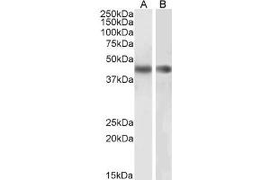 Western Blotting (WB) image for anti-Actin, alpha 2, Smooth Muscle, Aorta (ACTA2) (N-Term) antibody (ABIN185271)