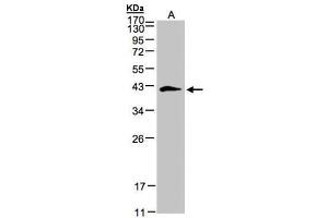 WB Image Sample(30 ug whole cell lysate) A:293T 12% SDS PAGE antibody diluted at 1:500 (Biglycan 抗体)