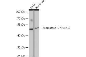 Western blot analysis of extracts of various cell lines, using Aromatase (CYP19) antibody (2684) at 1:3000 dilution. (Aromatase 抗体  (AA 1-180))