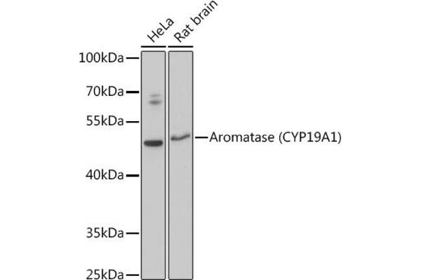 Aromatase Antikörper  (AA 1-180)