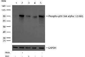 All lanes : Phospho-p90 S6K alpha 1 (S380) Rabbit mAb at 1/1k dilution Lane 1 : Hela whole cell lysates Lane 2 : Hela treated with 200nM PMA for 30 min whole cell lysates Lane 3 :Hela treated with 100 ng/mL EGF for 20 min whole cell lysates Lane 4 : JK whole cell lysates Lane 5 : JK treated with 200nM PMA for 30 min whole cell lysates Lysates/proteins at 20 μg per lane. (Recombinant RPS6KA1 抗体  (pSer380))