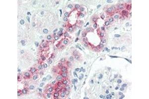 IHC analysis of FFPE human kidney tissue stained with BMPR2 antibody