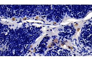 Detection of TLR4 in Rat Thymus Tissue using Polyclonal Antibody to Toll Like Receptor 4 (TLR4)