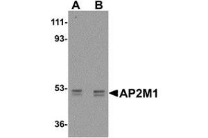 Western Blotting (WB) image for anti-Adaptor-Related Protein Complex 2, mu 1 Subunit (AP2M1) (C-Term) antibody (ABIN1030240) (AP2M1 抗体  (C-Term))