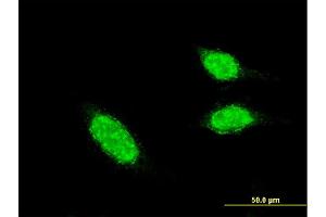 Immunofluorescence of monoclonal antibody to BLID on HeLa cell. (BLID 抗体  (AA 2-108))