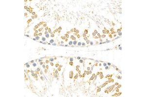 Immunohistochemistry analysis of paraffin-embedded rat testis using Torsin A (ABIN7075942) at dilution of 1: 800 (TOR1A 抗体)