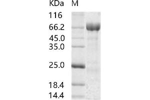 MERS-Coronavirus Spike Protein (MERS-CoV S) (Active) protein (His tag,ECD)