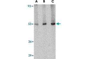 Western blot analysis of CRLF2 in human liver tissue lysate with CRLF2 polyclonal antibody  at (A) 0. (CRLF2 抗体  (Internal Region))