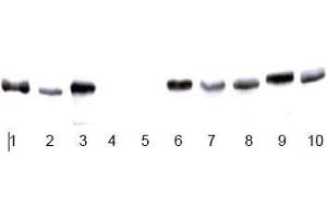 Image no. 4 for anti-Glyceraldehyde-3-Phosphate Dehydrogenase (GAPDH) antibody (ABIN284439) (GAPDH 抗体)